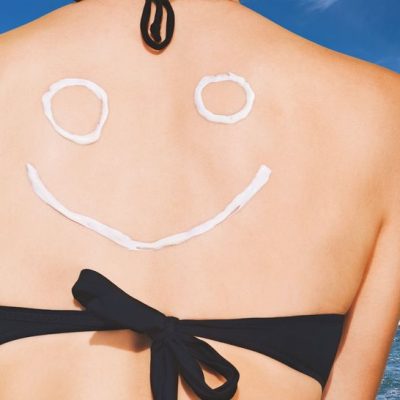 vegan sunburn cures