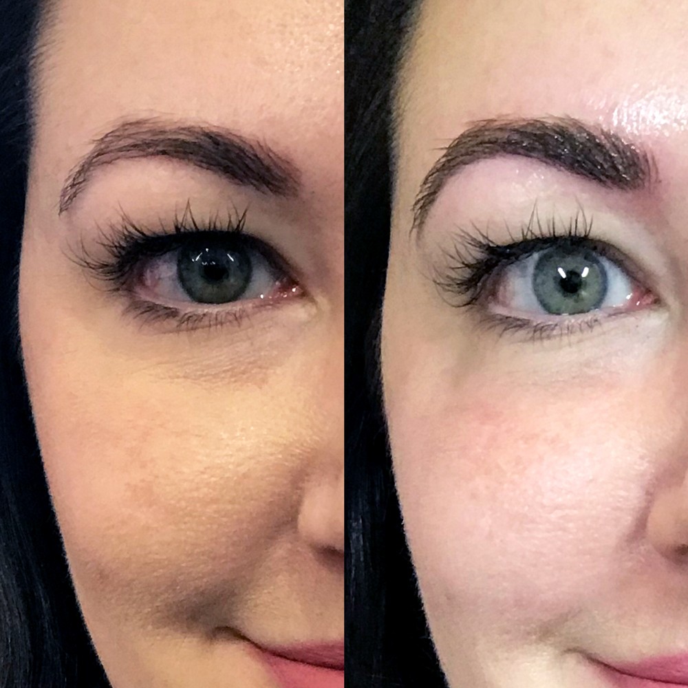 Before and After Thread Microblading Touch Up