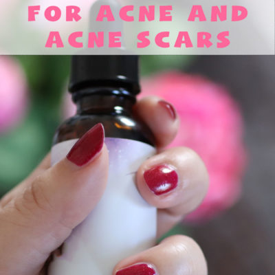 DIY skincare recipes for acne and acne scars