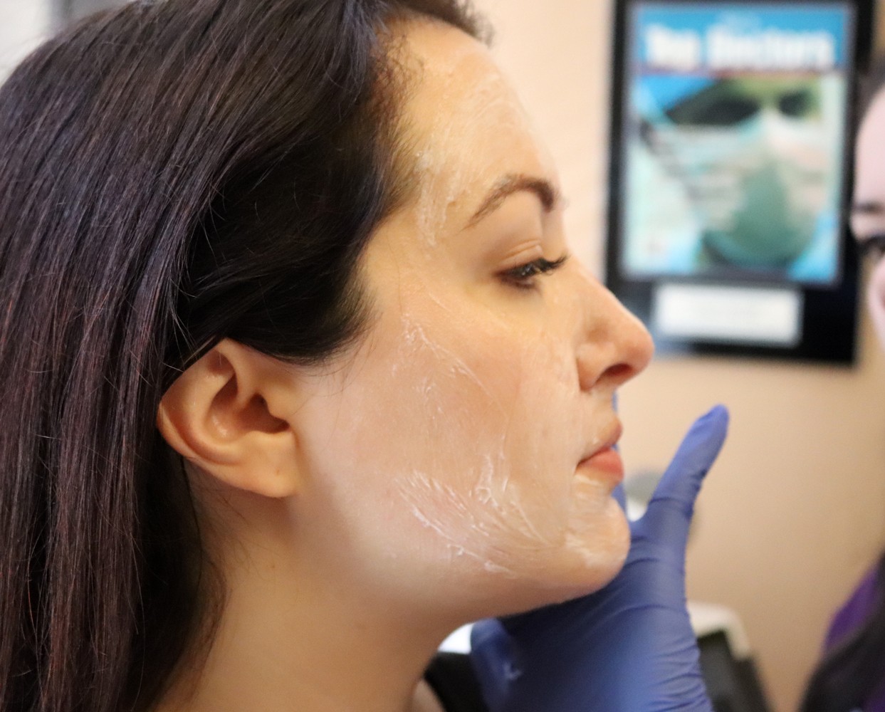 PiQo4 Laser - the Only Melasma Treatment that has Ever Worked for Me! featured by popular Los Angeles cruely free beauty blogger My Beauty Bunny 