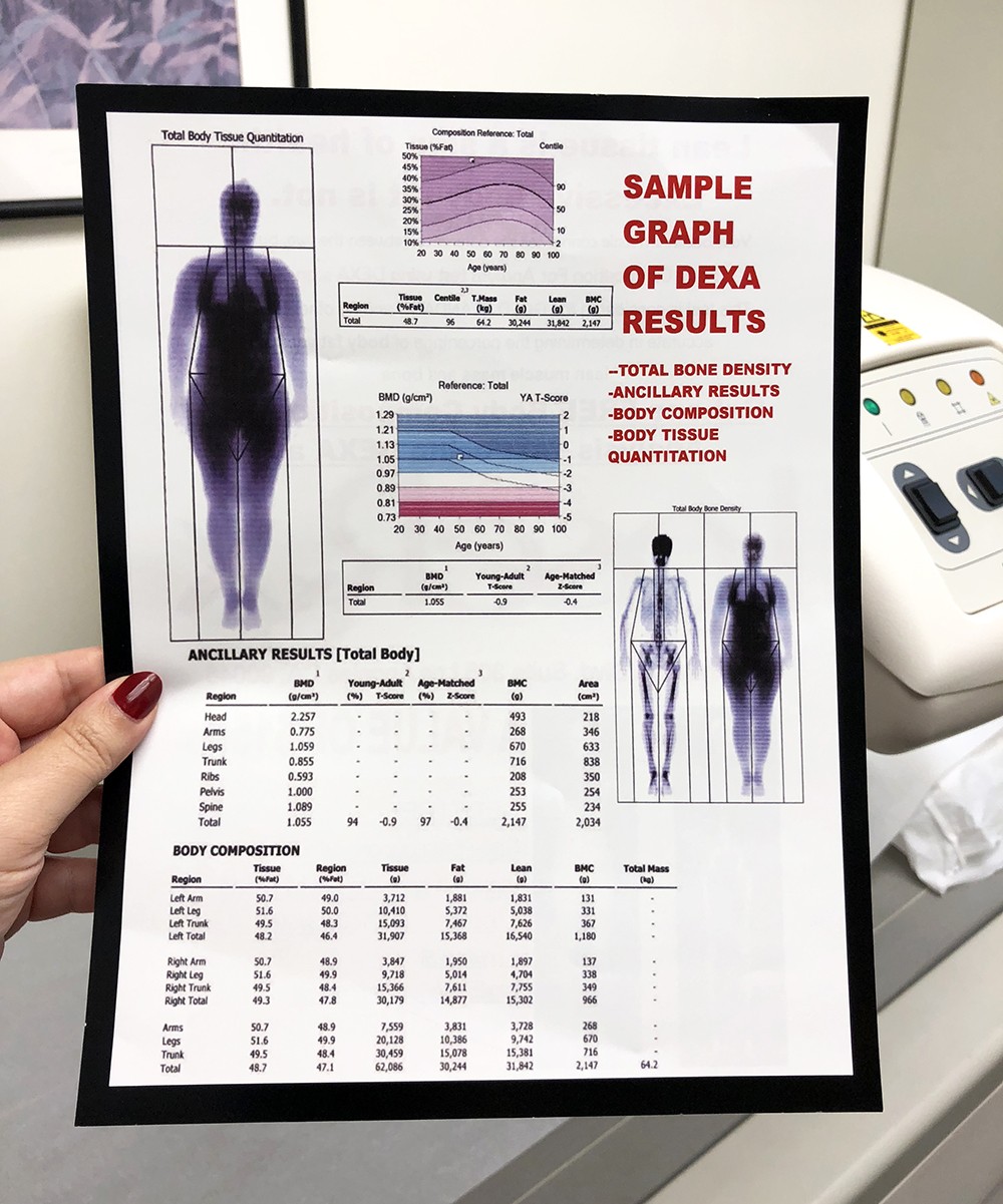 Dexa Scan - My Second SculpSure Body Contouring Treatment at LaserXX - Wedding Prep featured by popular Los Angeles beauty blogger My Beauty Bunny 