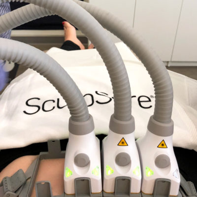 My SculpSure Body Contouring Treatment Experience at LaserXX Med Spa in Los Angeles