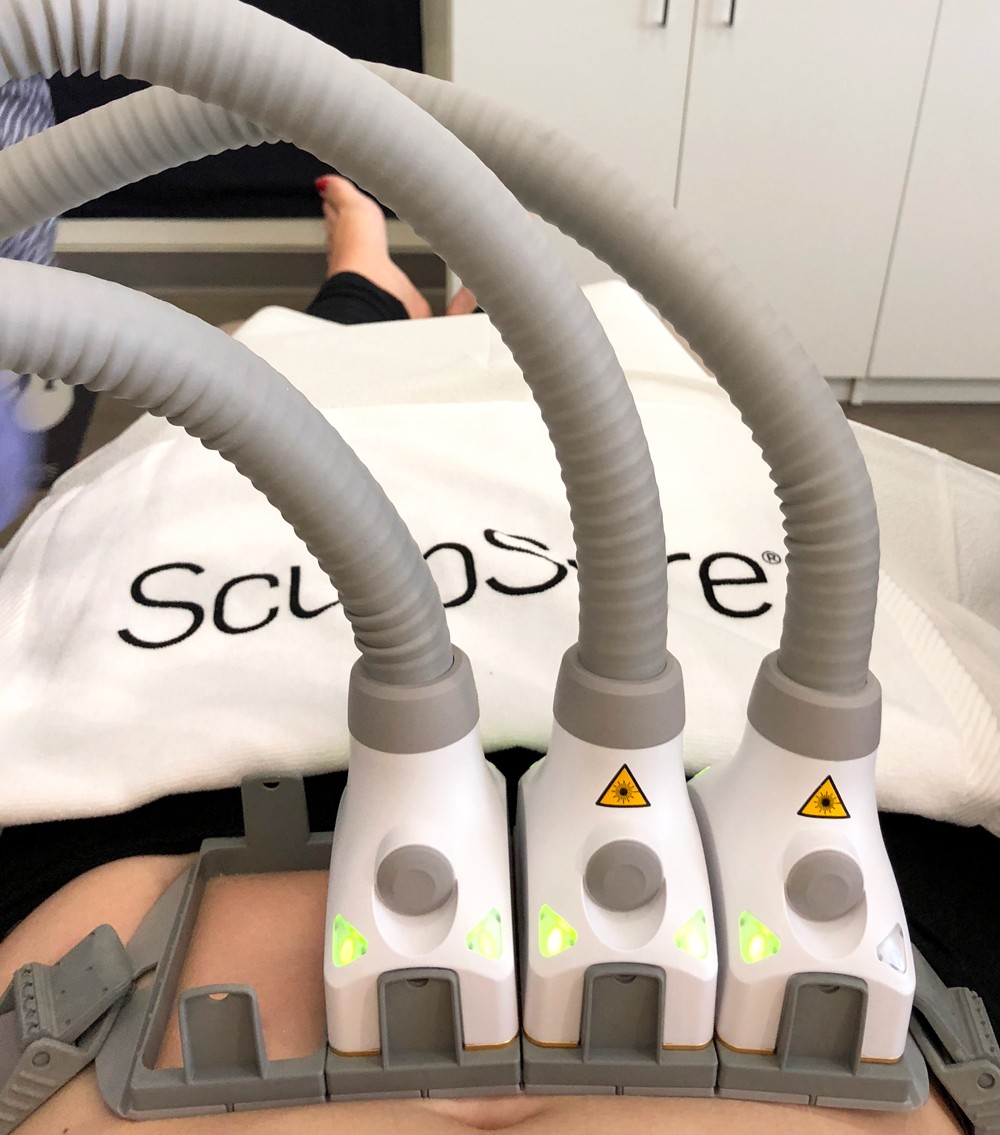 Wedding Prep: SculpSure Body Contouring at LaserXX featured by popular Los Angeles beauty blogger My Beauty Bunny