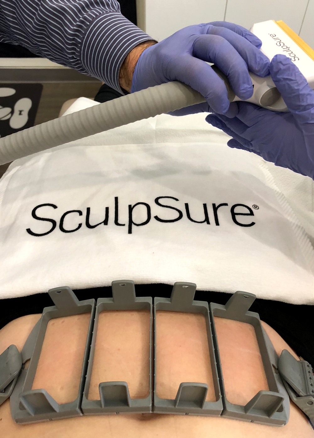 Wedding Prep: SculpSure Body Contouring at LaserXX featured by popular Los Angeles beauty blogger My Beauty Bunny